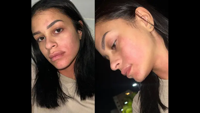 Ex-namorada diz ter sido agredida por Kauê, do Botafogo; jogador nega acusações